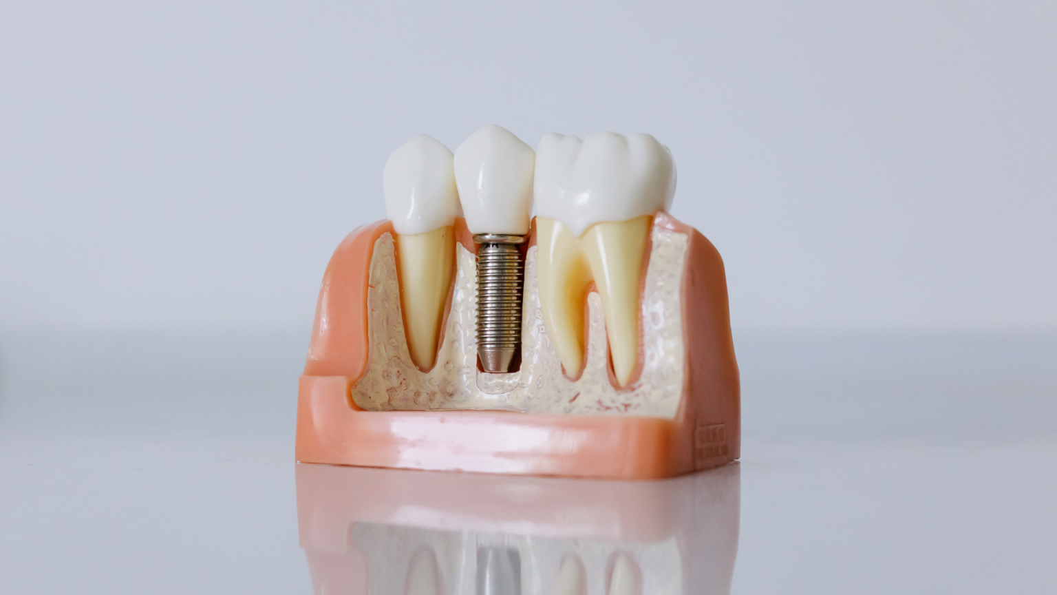 Dental Implants vs. Natural Teeth: A Complete Guide for Scottsdale Patients