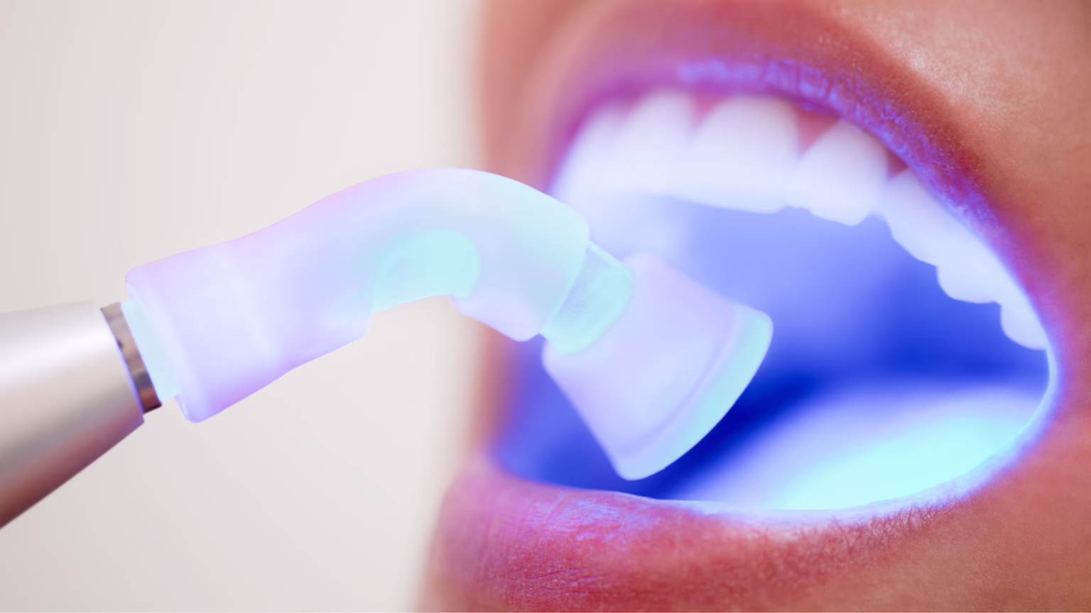 Modern Fillings That Blend Seamlessly with Your Smile