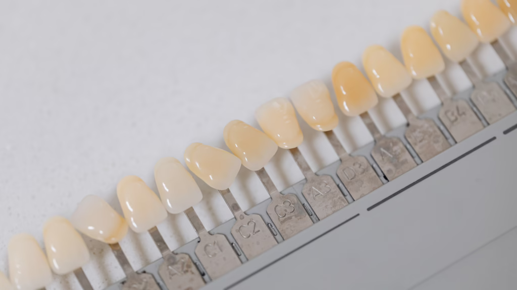 Professional Teeth Whitening in Scottsdale: How It Works and Why It’s Worth It