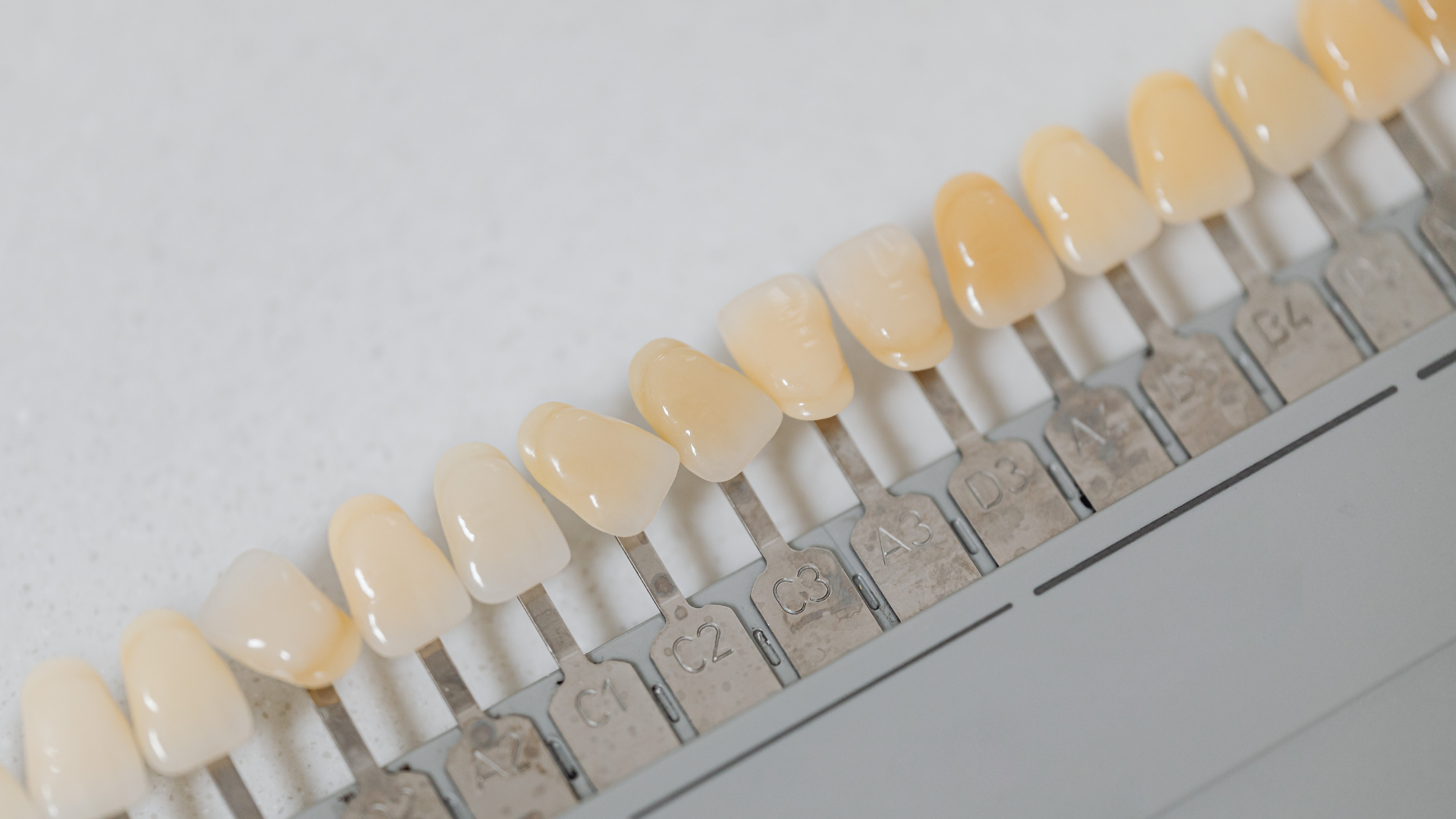 Professional Teeth Whitening in Scottsdale: How It Works and Why It’s Worth It