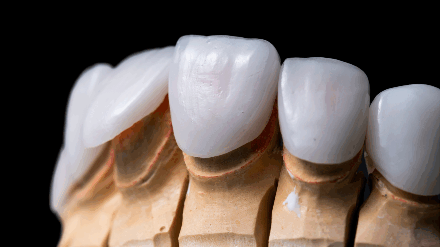 Does Winter Make Cosmetic Dentistry More Sensitive?