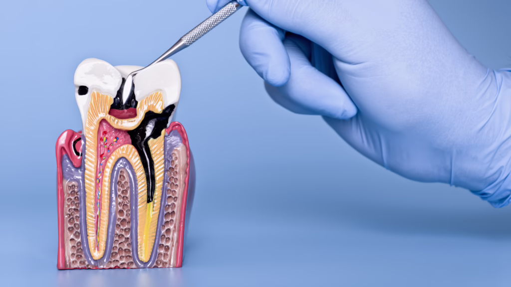 Will Antibiotics Cure a Tooth Infection?