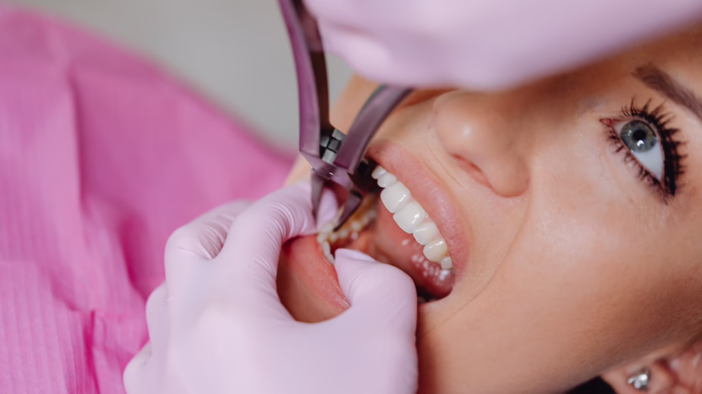 Can a Cracked Tooth Be Saved?