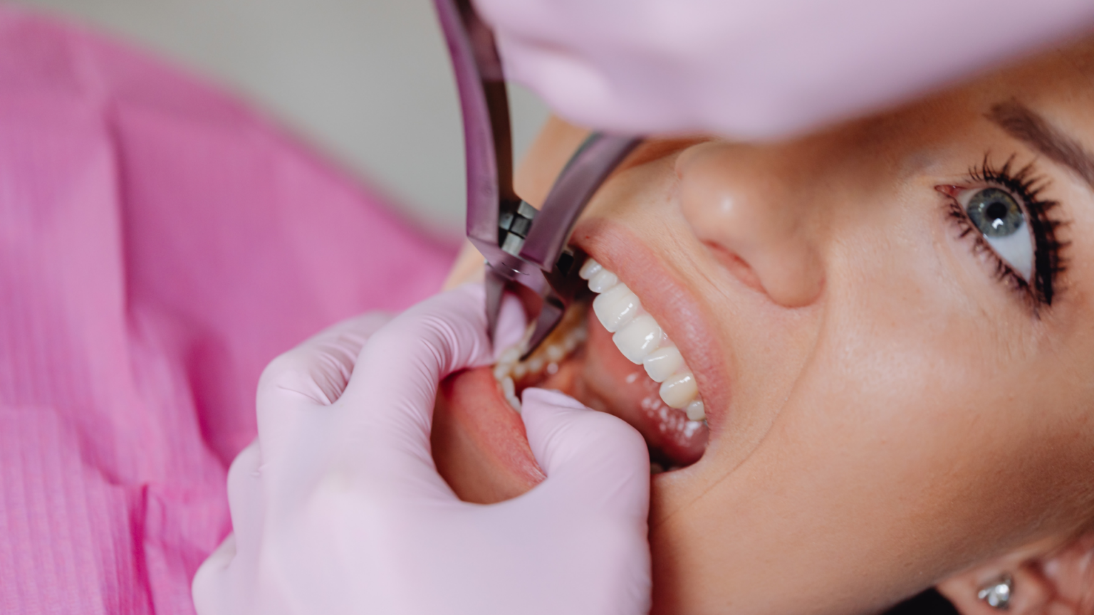Can a Cracked Tooth Be Saved?