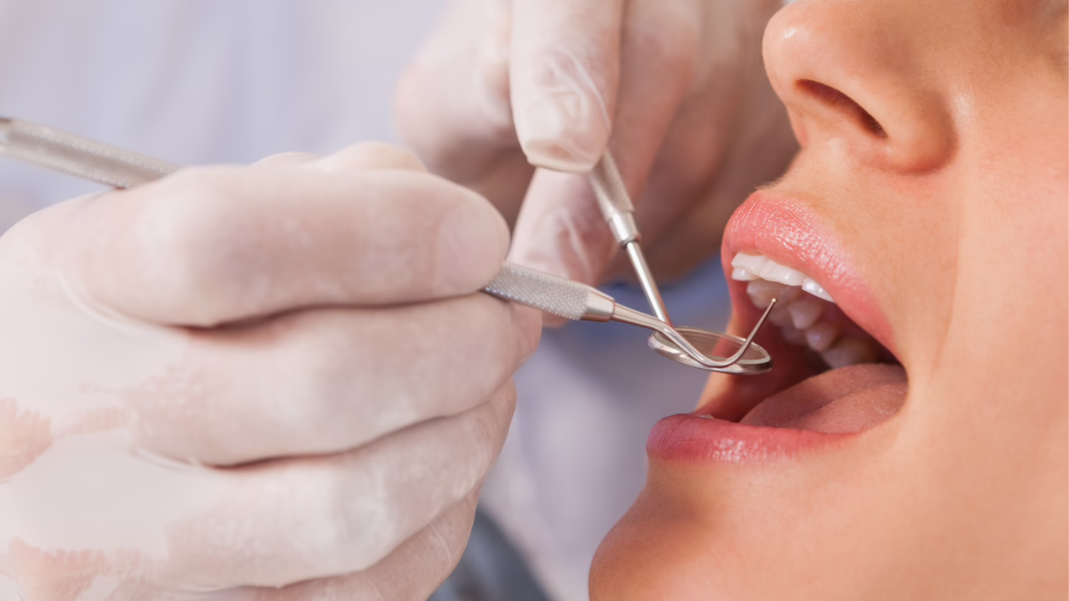 Canker Sore vs. Oral Cancer Symptoms: When Should You Be Concerned?